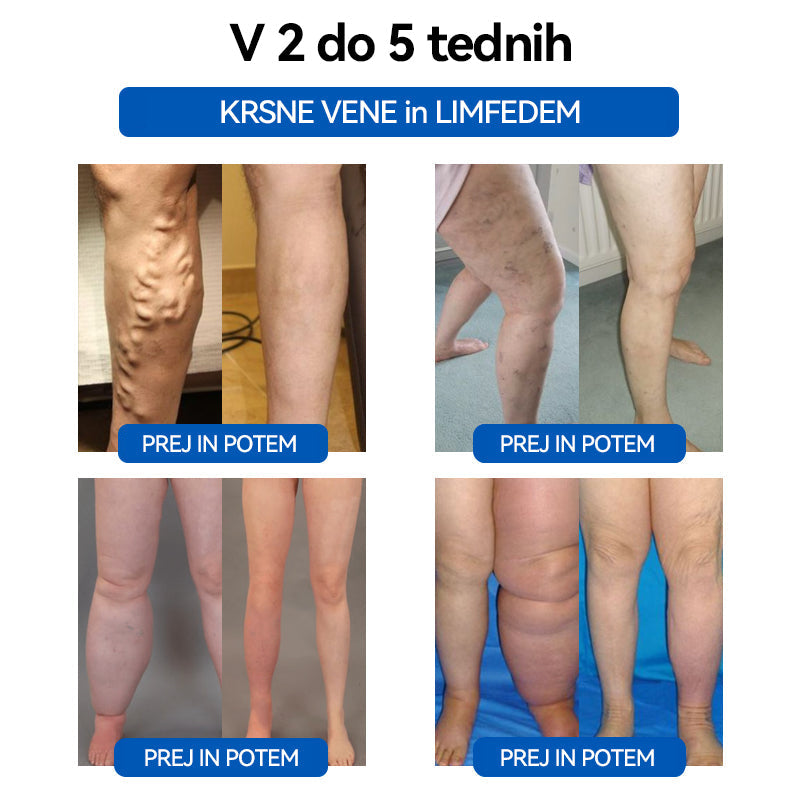 𝐂𝐙𝐓𝐈𝐂𝐋𝐄™ 🦋𝐔𝐥𝐭𝐫𝐚𝐳𝐯𝐨č𝐧𝐨 𝐩𝐞𝐬𝐤𝐚𝐧𝐣𝐞 𝐦𝐚šč𝐨𝐛 𝐃𝐚𝐥𝐞č 𝐢𝐧𝐟𝐫𝐚𝐫𝐝𝐞č𝐞 𝐤𝐫𝐯𝐧𝐢 𝐬𝐥𝐚𝐝𝐤𝐨𝐫  𝐮𝐫𝐚𝐯𝐧𝐨𝐭𝐞ž𝐞𝐧𝐣𝐞 𝐃𝐞𝐭𝐨𝐱 𝐳𝐚𝐩𝐞𝐬𝐭𝐧𝐢𝐜𝐚⏰(🔥🔥Priporočajo plastični kirurgi)