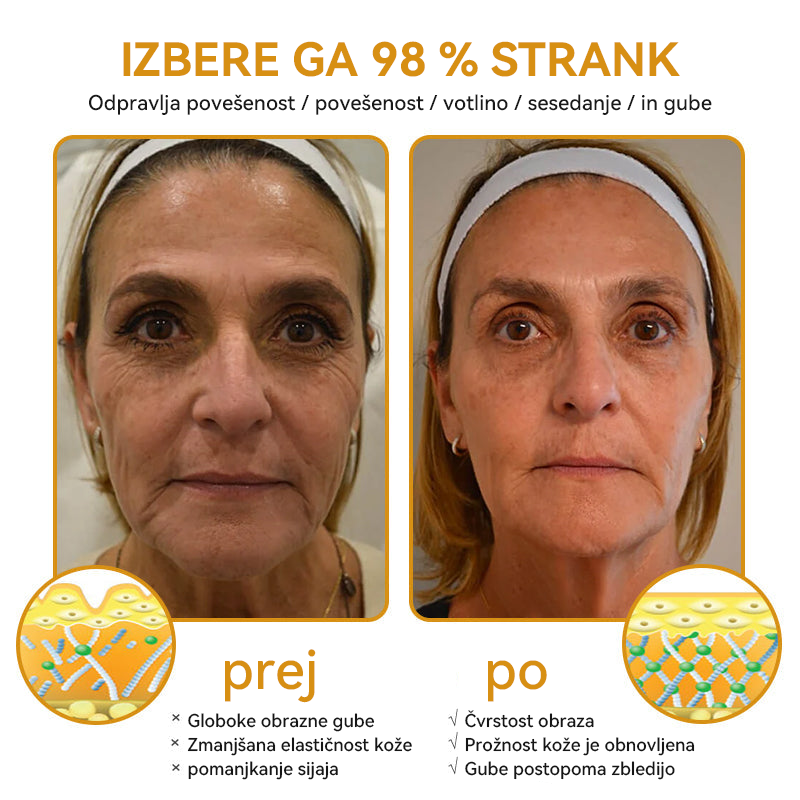 (🎁 Ekskluzivna posebna ponudba - 70 % popust - ne zamudite!) 𝐒𝐩𝐳𝐲™ 𝐁𝐎𝐓𝐎𝐗 Strije proti staranju z medenim strupom