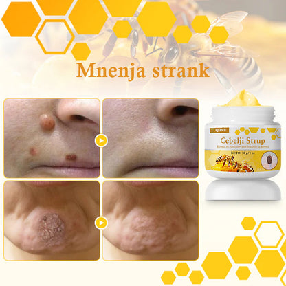 🐝𝐒𝐩𝐳𝐯® Č𝐞𝐛𝐞𝐥𝐣𝐢 𝐒𝐭𝐫𝐮𝐩 𝐊𝐫𝐞𝐦𝐚 𝐳𝐚 𝐨𝐝𝐬𝐭𝐫𝐚𝐧𝐣𝐞𝐯𝐚𝐧𝐣𝐞 𝐛𝐫𝐚𝐝𝐚𝐯𝐢𝐜 𝐢𝐧 𝐤𝐫𝐞𝐭𝐞𝐧𝐣, Certificirano s strani JAZMP (Slovenska agencija za zdravila in medicinske pripomočke) 💖 Zdravi bradavice, kožne izrastke, okužbe in keratozo, gladi neenakomerno kožo