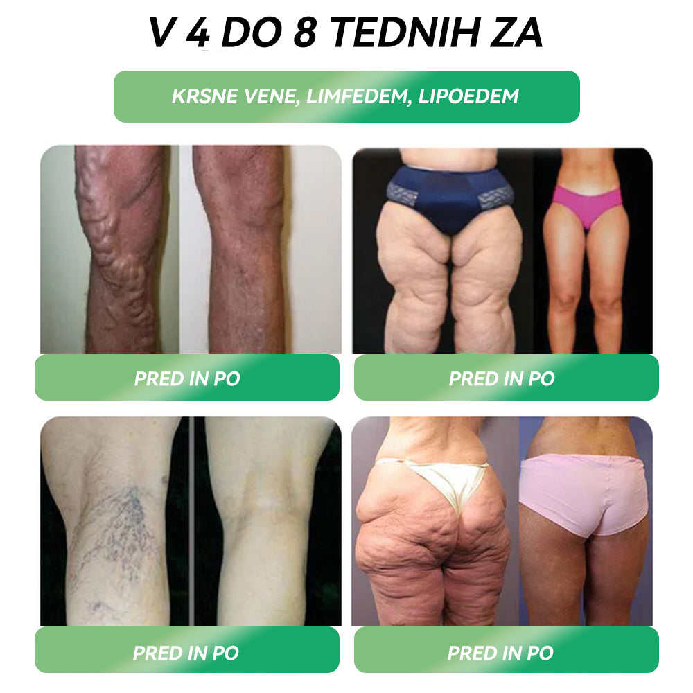 Priporočila Univerzitetne bolnišnice v Ljubljani ||Uradna trgovina | 💗𝑆𝑇𝐷𝐸𝐼® 𝐺𝐿𝑃-1 𝐼𝑧𝑔𝑢𝑏𝑎 𝑇𝑒ž𝑒 𝑈𝑠𝑡𝑛𝑎 𝑅𝑒š𝑖𝑡𝑒𝑣 - 👨‍⚕ Debelost, bolezni srca in ožilja, diabetes, spalna apneja, težave s sklepi in še več