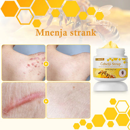 🐝𝐒𝐩𝐳𝐯® Č𝐞𝐛𝐞𝐥𝐣𝐢 𝐒𝐭𝐫𝐮𝐩 𝐊𝐫𝐞𝐦𝐚 𝐳𝐚 𝐨𝐝𝐬𝐭𝐫𝐚𝐧𝐣𝐞𝐯𝐚𝐧𝐣𝐞 𝐛𝐫𝐚𝐝𝐚𝐯𝐢𝐜 𝐢𝐧 𝐤𝐫𝐞𝐭𝐞𝐧𝐣, Certificirano s strani JAZMP (Slovenska agencija za zdravila in medicinske pripomočke) 💖 Zdravi bradavice, kožne izrastke, okužbe in keratozo, gladi neenakomerno kožo