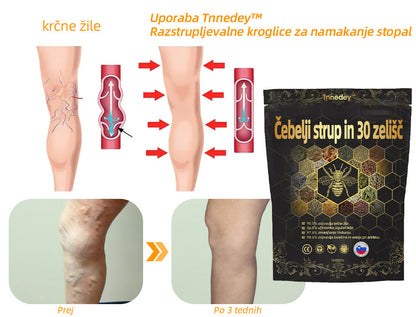 🚚📦Zadnji dan, da bi dobili 70% OFF: Tnnedey® 𝑽č𝒆𝒍í 𝒋𝒆𝒅 𝒂 30 𝒃𝒚𝒍𝒊𝒏𝒏é 𝒅𝒆𝒕𝒐𝒙𝒊𝒌𝒂č𝒏é 𝒈𝒖ľôč𝒌𝒚 𝒏𝒂 𝒌ú𝒑𝒆ľ 𝒏ô𝒉 𝒑𝒓𝒆 𝒕𝒗𝒂𝒓𝒐𝒗𝒂𝒏𝒊𝒆 𝒕𝒆𝒍𝒂- Priporoča Ameriška limfna akademija (ALA)🧀