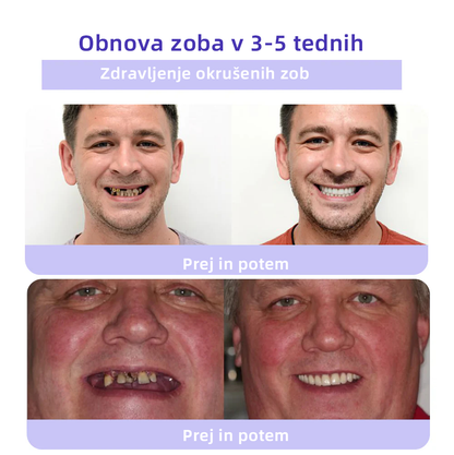 𝐎𝐲𝐢𝐤𝐞𝐲™ Mineralni prah za obnovo zob 🦷 (Priporočeno s strani SDA) (🎁 Časovno omejena akcija - Ne zamudite)