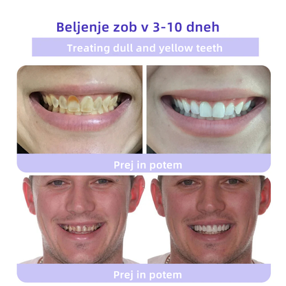 𝐎𝐲𝐢𝐤𝐞𝐲™ Mineralni prah za obnovo zob 🦷 (Priporočeno s strani SDA) (🎁 Časovno omejena akcija - Ne zamudite)