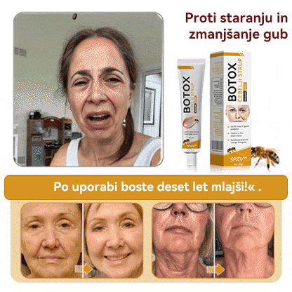 (🎁 Ekskluzivna posebna ponudba - 70 % popust - ne zamudite!) 𝐒𝐩𝐳𝐲™ 𝐁𝐎𝐓𝐎𝐗 Strije proti staranju z medenim strupom